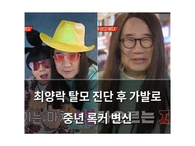 최양락 탈모 진단 후 가발로 중년 록커 변신